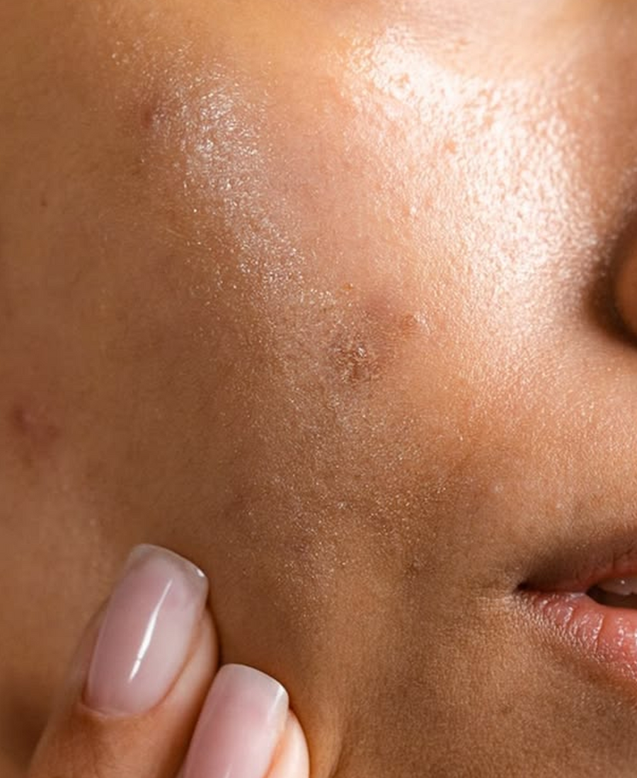 Dull or Uneven Skin